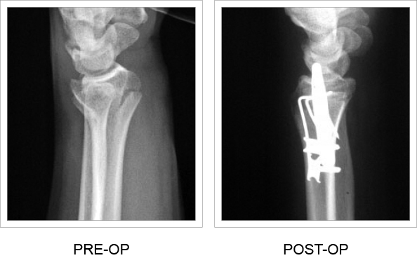 Side-by-side x-ray comparison