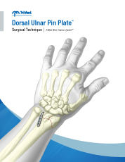 Dorsal Ulnar Pin Plate surgical technique manual cover